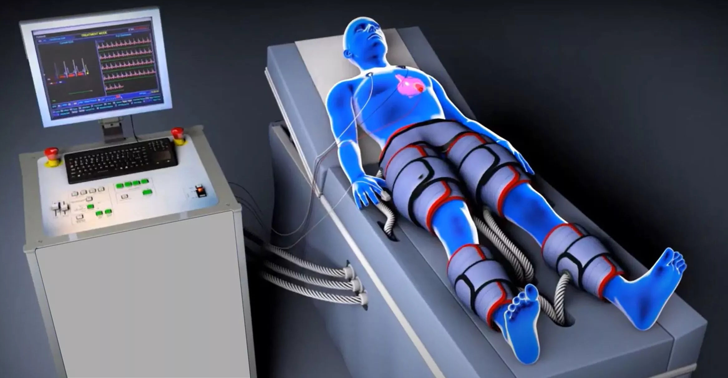 Cardiac Care Monitoring